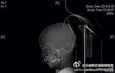 http://rumicn.com/uploadfile/2014/0821/20140821042153157.jpg